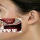Что такое лифтинг в стоматологии