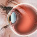 Revitalizing vision: Stem cell solutions unveiled